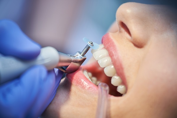 gum-therapy-what-happens-in-a-deep-teeth-cleaning-sharma-dental