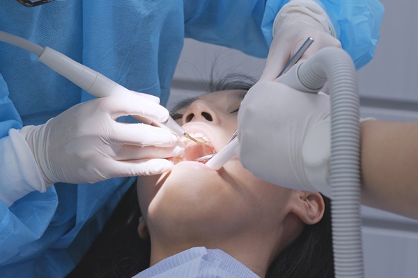 When You May Need A Deep Teeth Cleaning