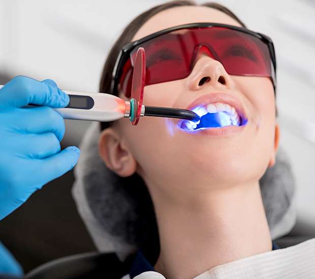 Dublin Professional Teeth Whitening