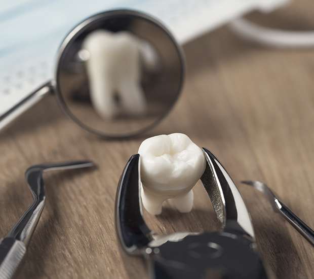 Dublin When Is a Tooth Extraction Necessary